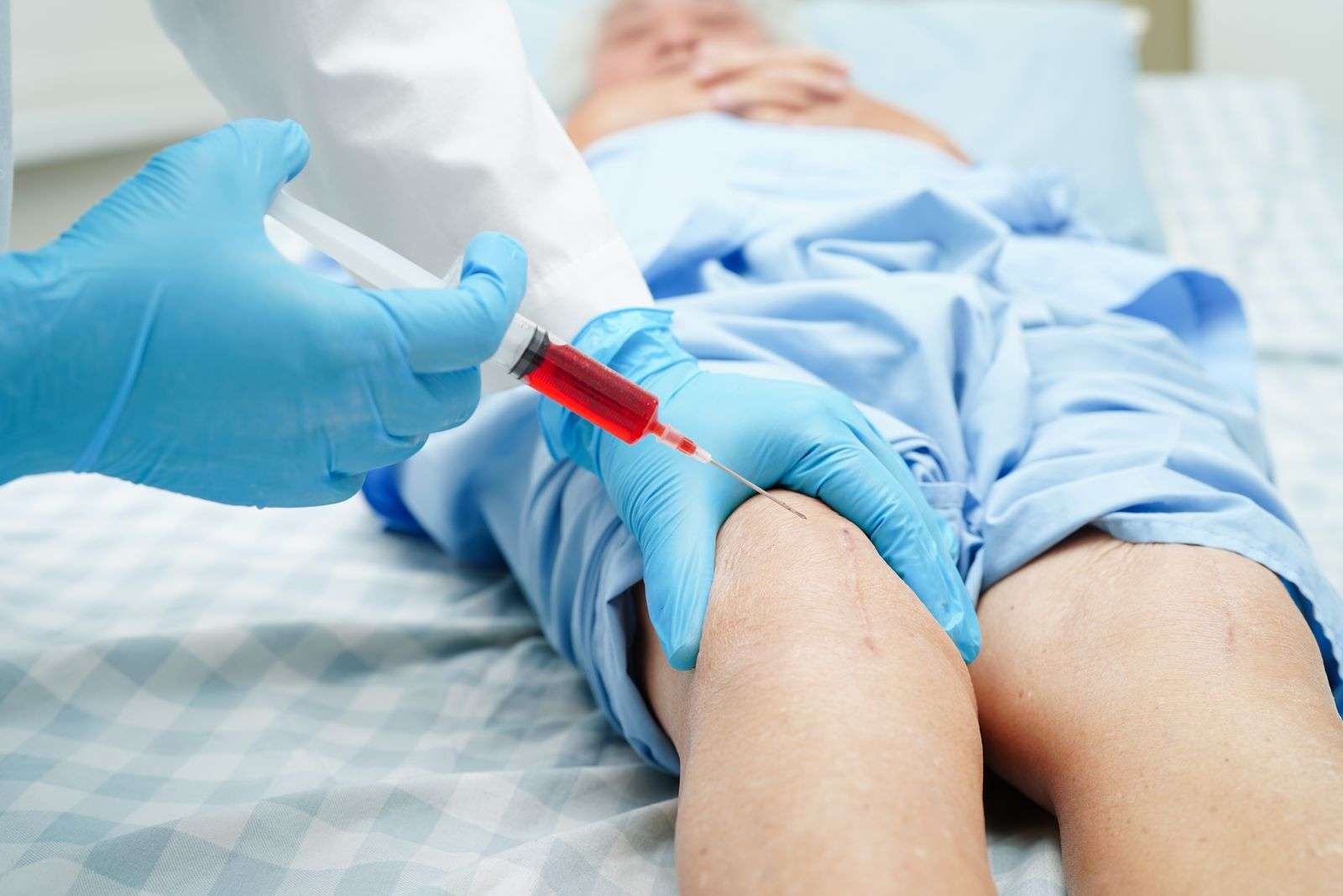 PRP knee injection 49619748 YI Platelet-Rich Plasma (PRP) injection into the knee to promote natural healing, tissue regeneration, and joint pain relief.