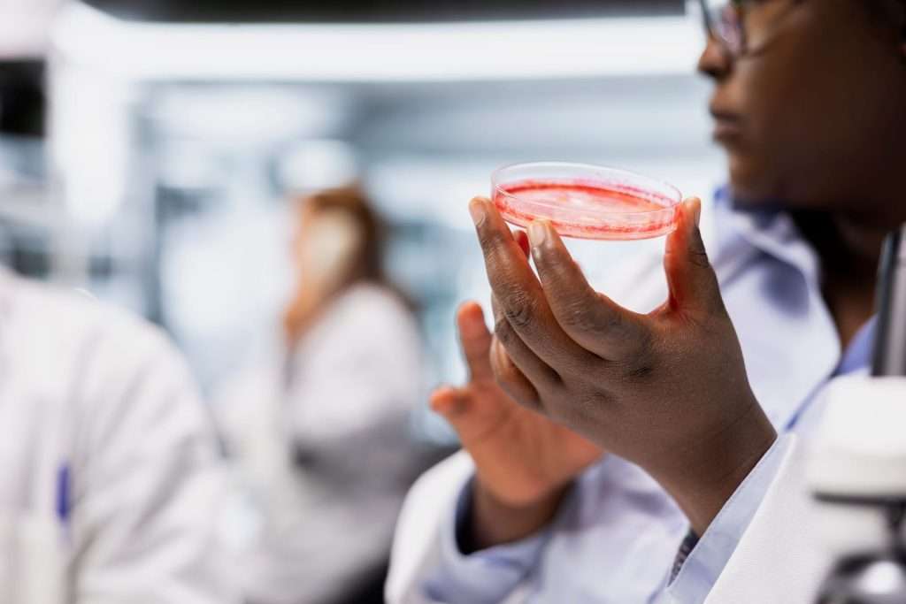 lab tech examining mold on petri dish 101232498 YI Laboratory technician examining mold cultures for mycotoxin testing and environmental mold exposure analysis.
