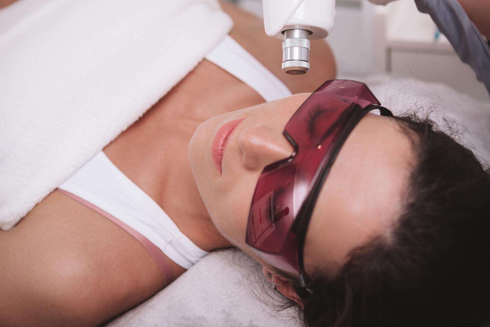laser skin treatment Patient receiving Phoenix CO₂ laser skin resurfacing treatment to improve wrinkles, sun damage, acne scars, and overall skin texture.